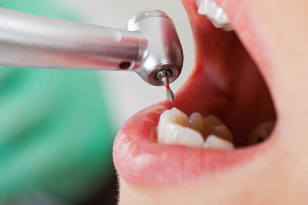 Best Emergency Dental Care for Abscessed Tooth in Guthrie, OK